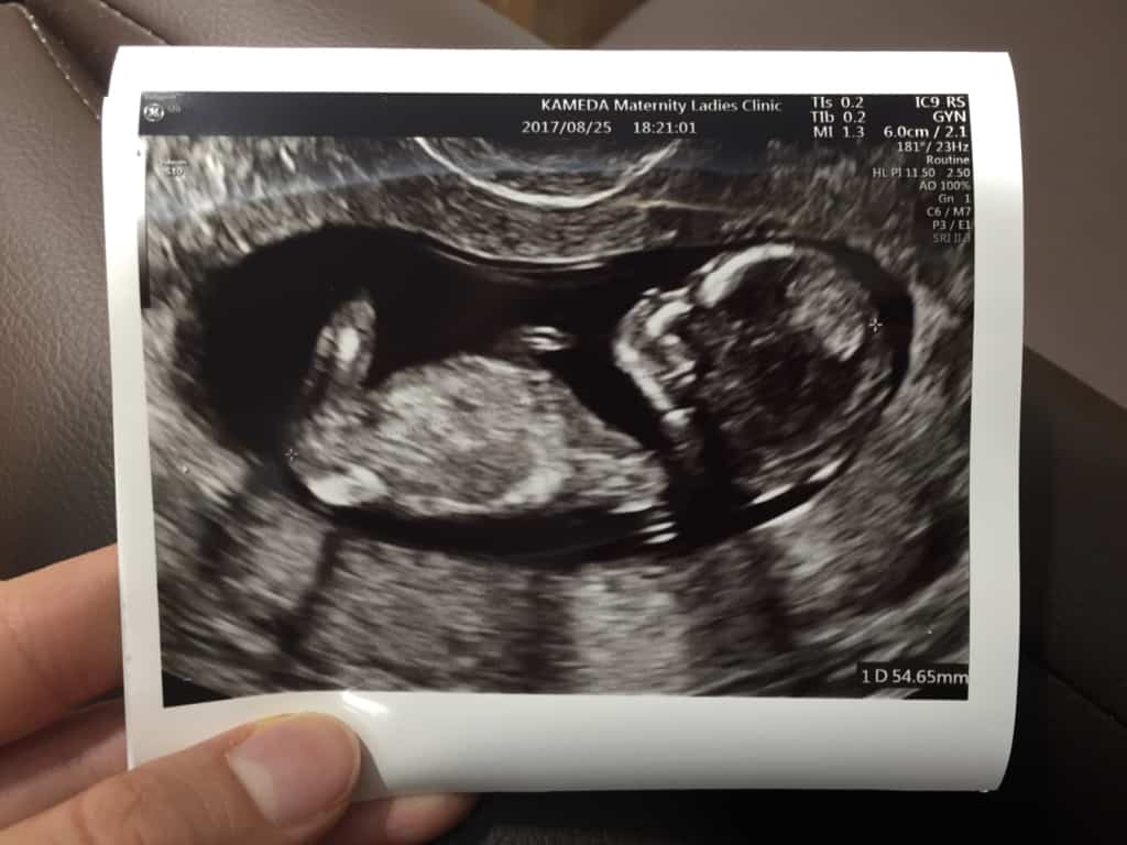 pregnant